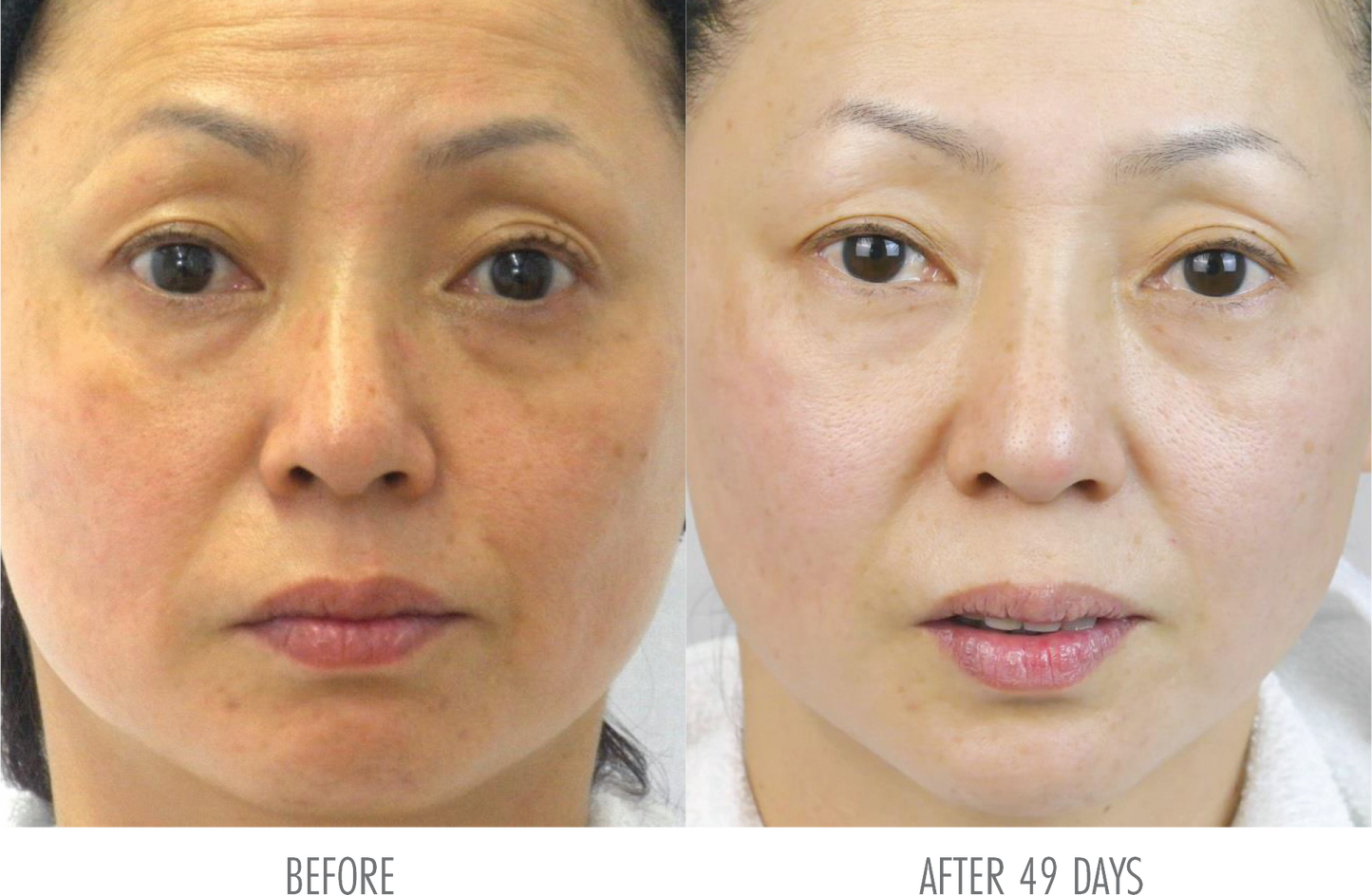 Co2 Lift PRO Mask Set of 3